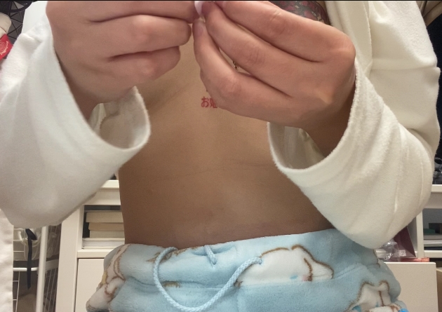 乳钉yin+chun上钉手术实拍：完美美容体验